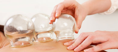The Reality Behind the Cupping Craze